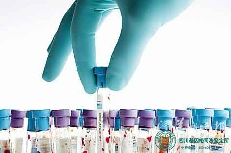 成都亲子鉴定如何走流程是最快的?